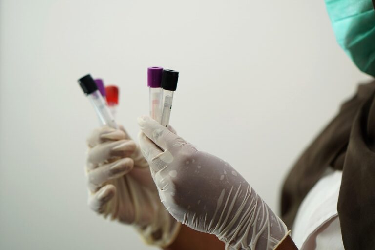 Cholesterolio mažinimas: LDL ir HDL balanso paieška